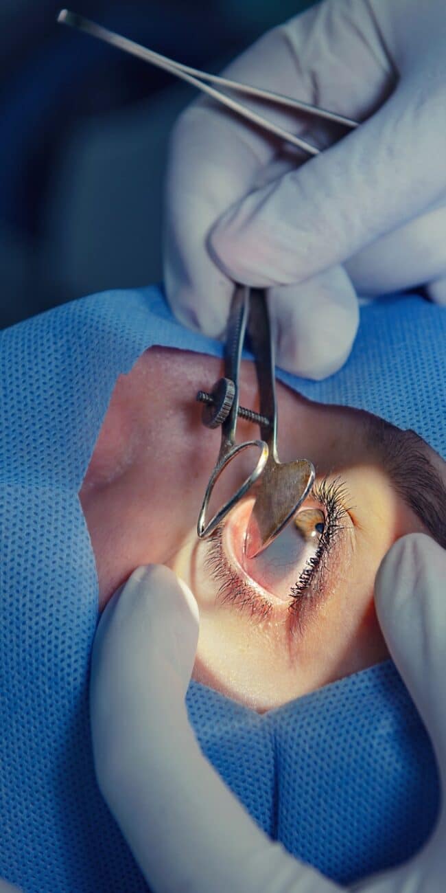 Operating room. Eye surgery