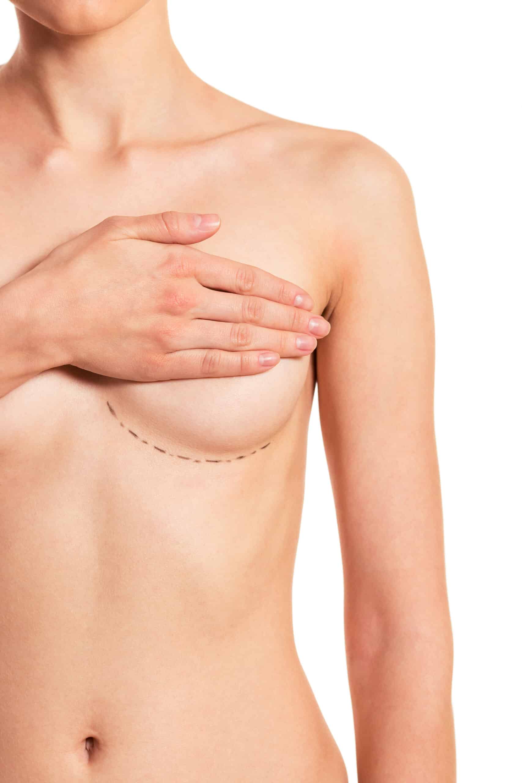 Preparation for breast surgery