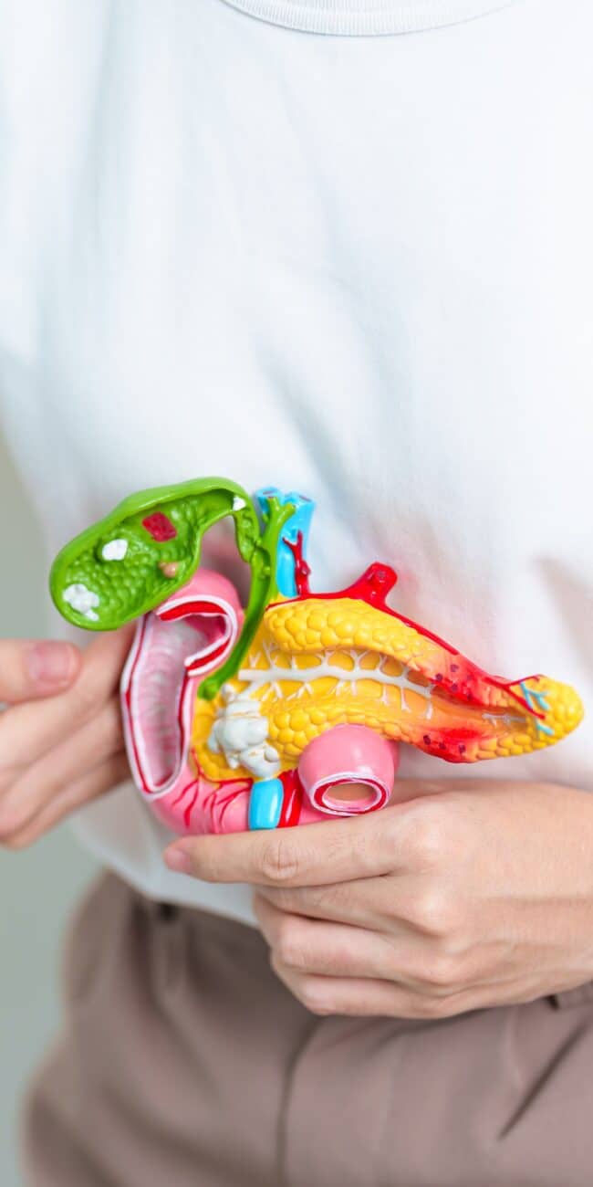 Woman holding human Pancreatitis anatomy with Pancreas